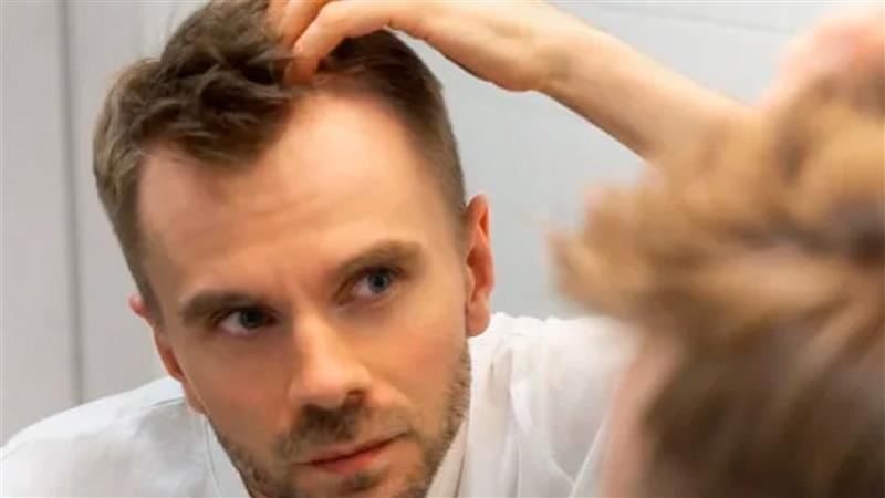 CAÍDA DEL CABELLO: Todo lo que necesitas saber para cuidar tu cabello