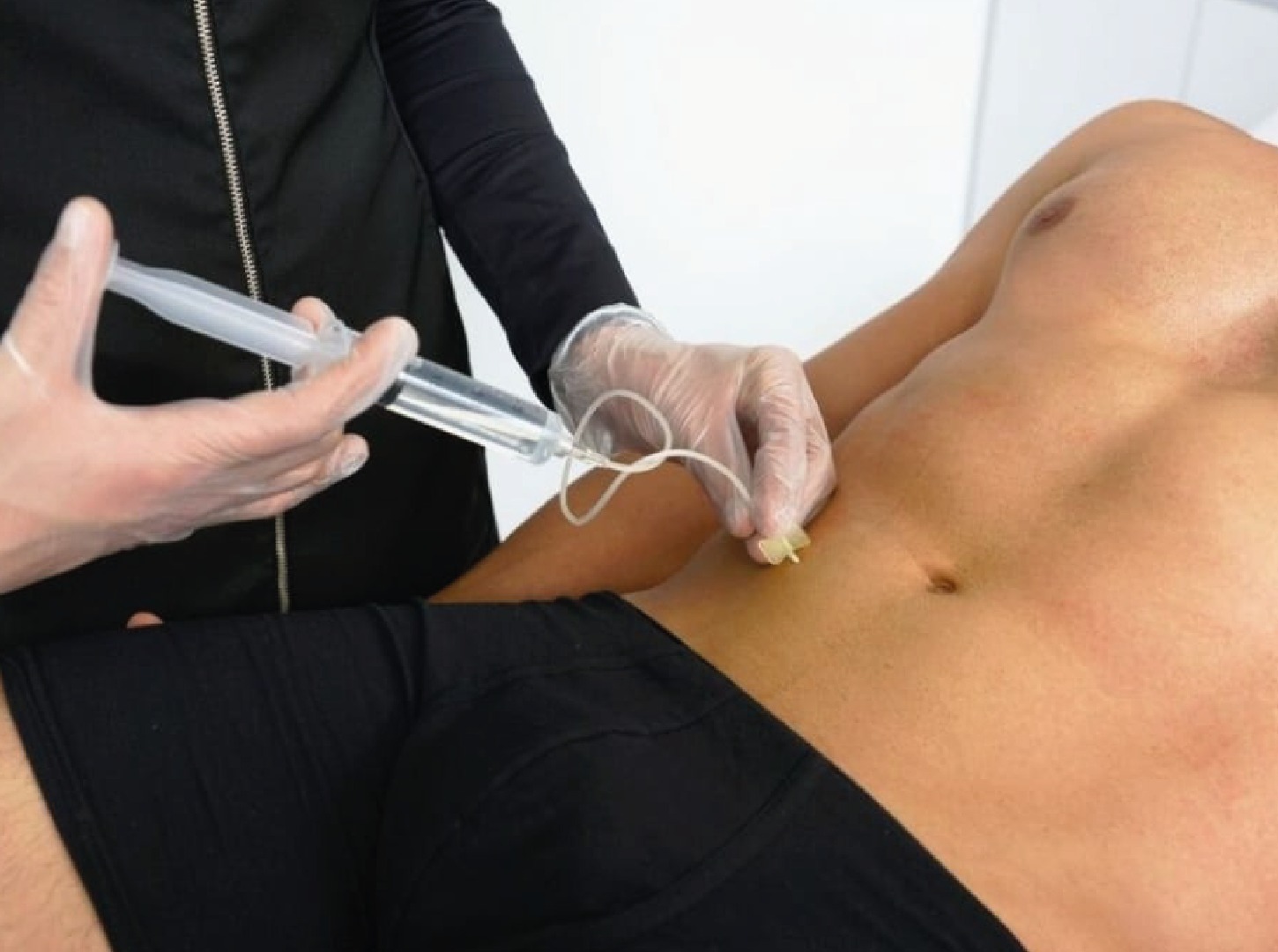 Hidrolipoclasia: Qué es, resultados y beneficios